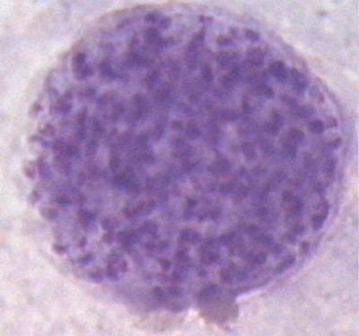 Toxoplasma gondii